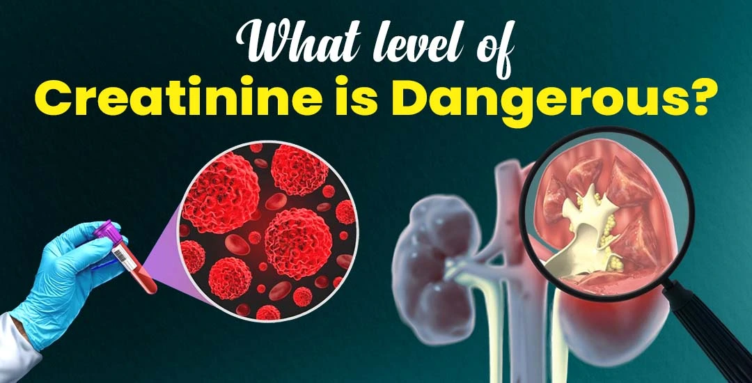 What Level of Creatinine Is Dangerous?